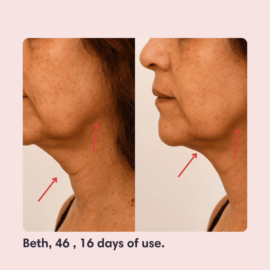 V-Face Lifting Mask