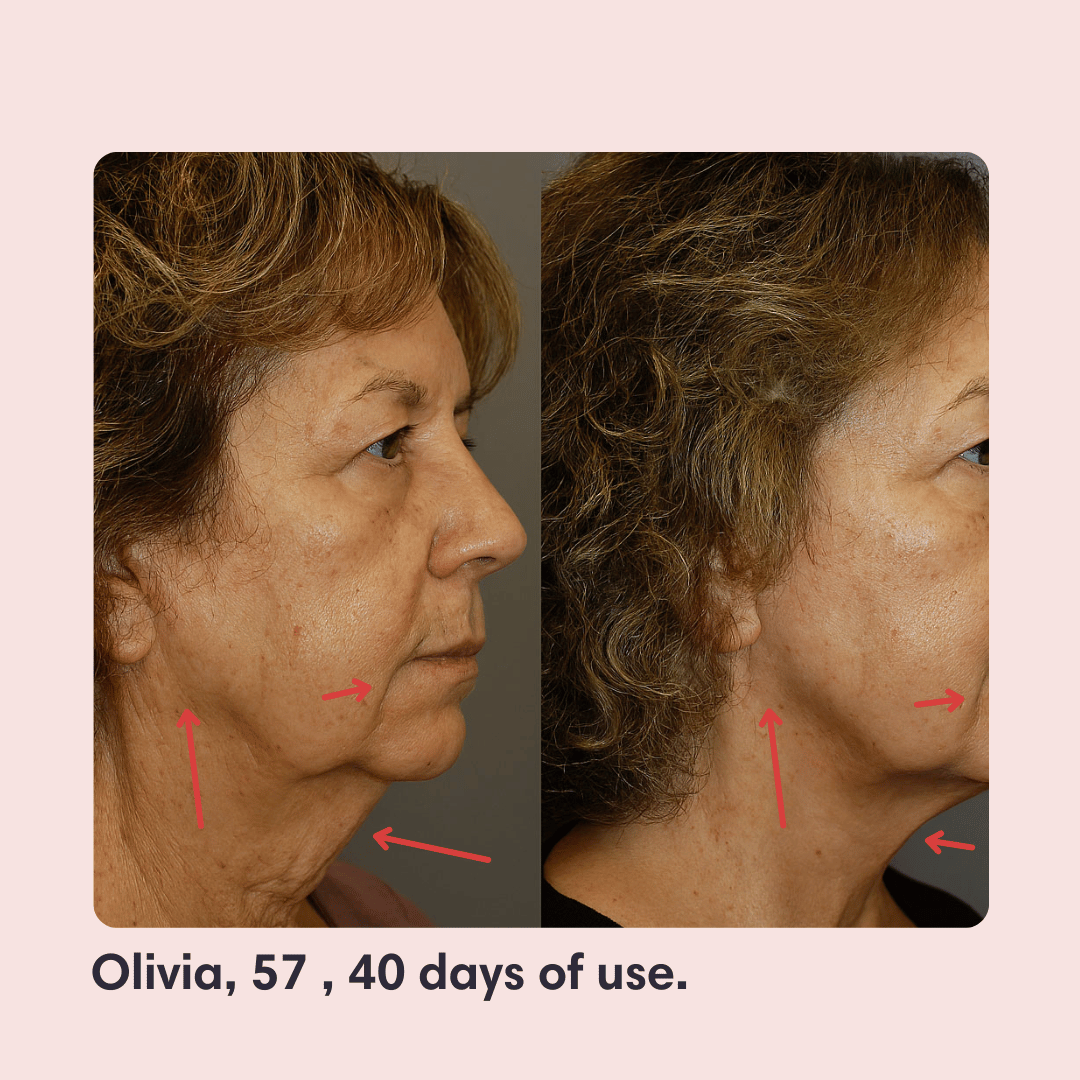 V-Face Lifting Mask
