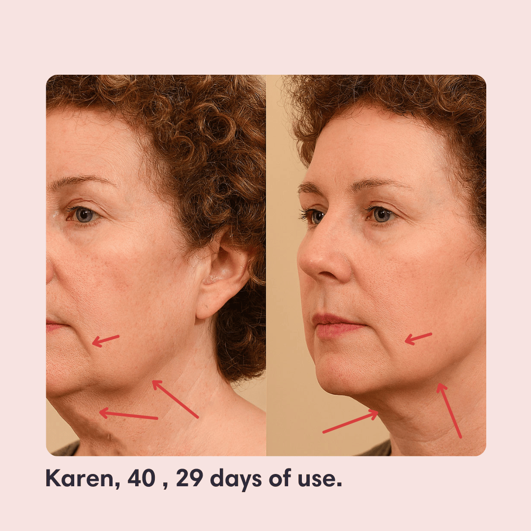 V-Face Lifting Mask