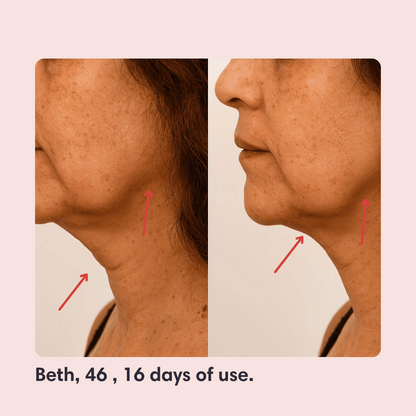 V-Face Lifting Mask